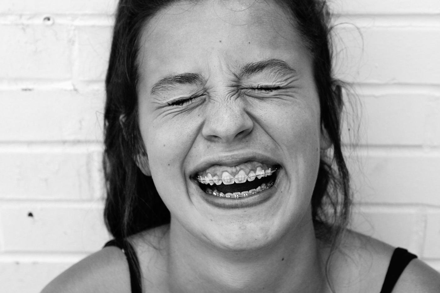Laughing woman with braces